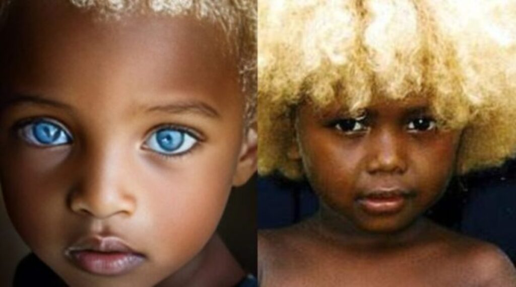 Tiva rixaka ra Melanesia ra misisi ya blonde ni mahlo ya wasi