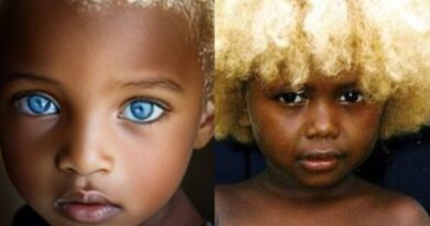 Tiva rixaka ra Melanesia ra misisi ya blonde ni mahlo ya wasi